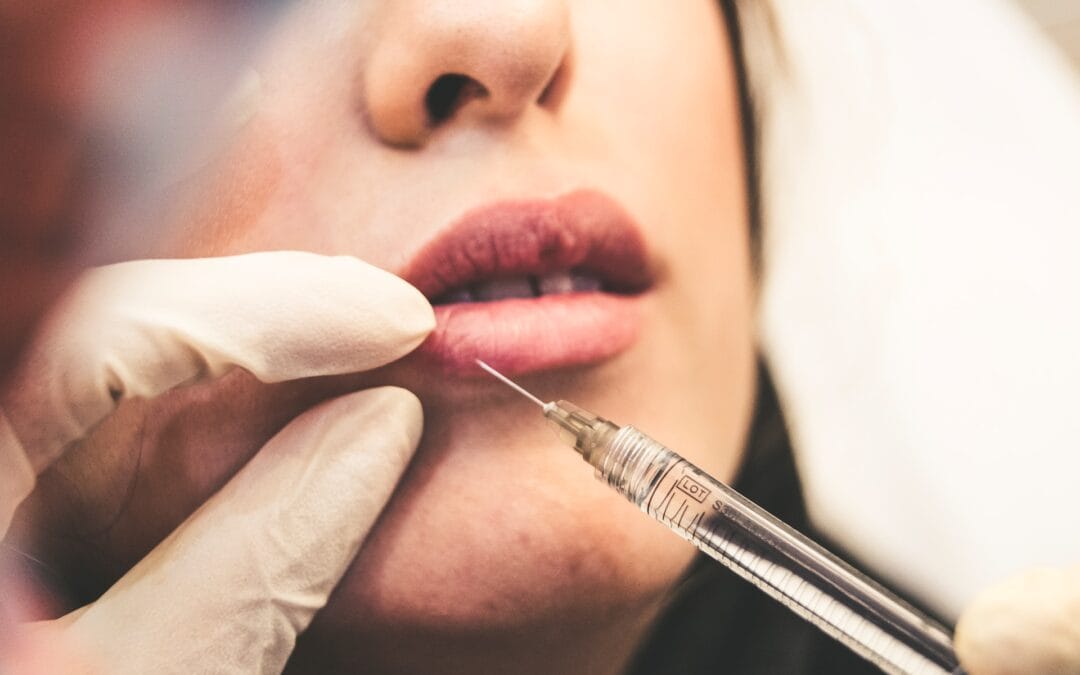 8 Telltale Signs That You Need to Have Dermal Fillers